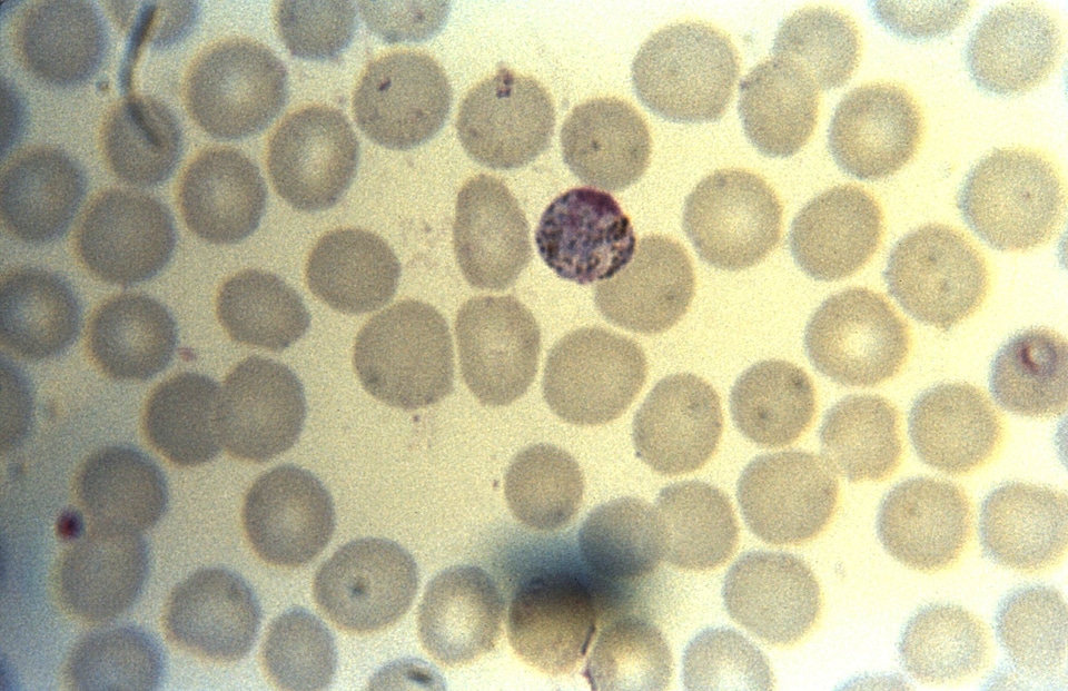 Magnitude morphology parasit
