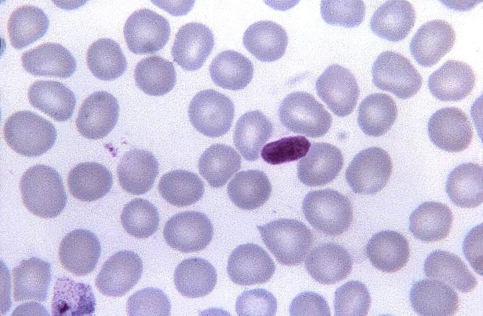 Artifact malaria parasit