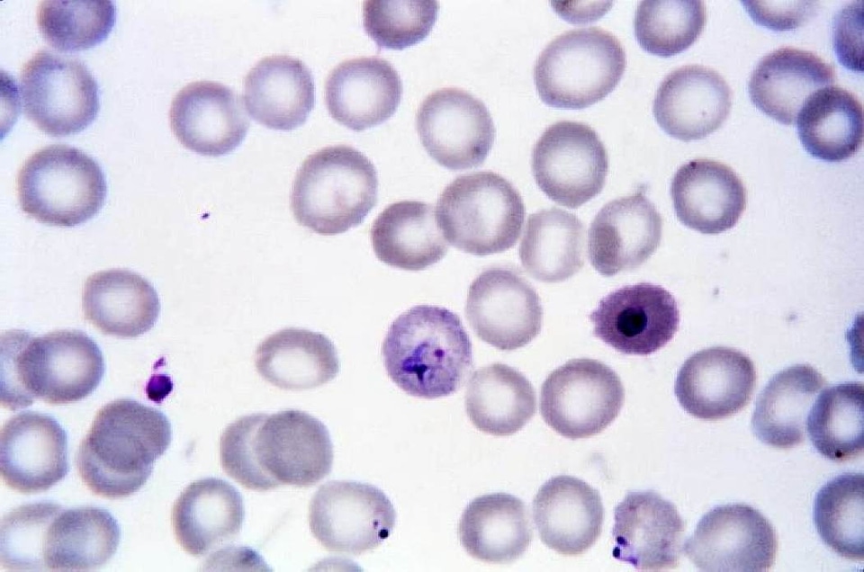 Form ring trophozoite