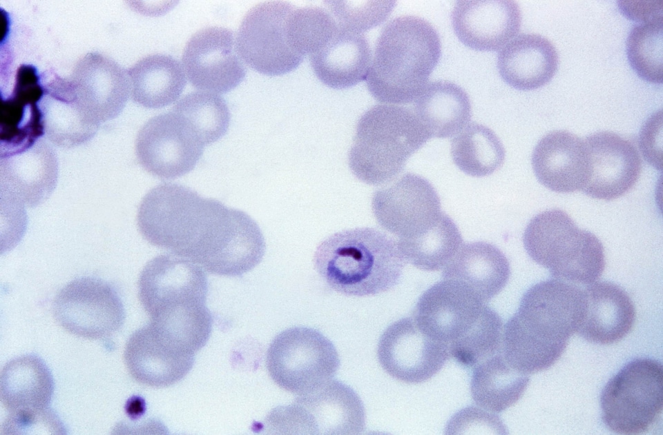 Crescent plasmodium teenage