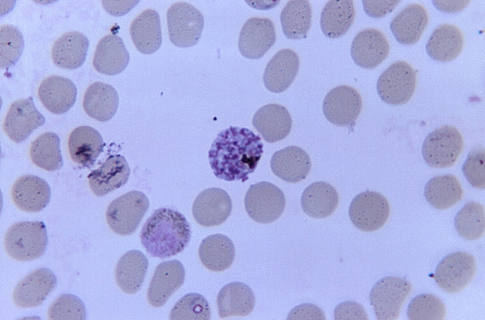 Blood gametocyte presence