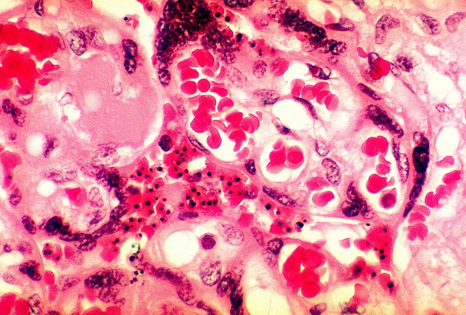 Parasit photomicrograph placenta