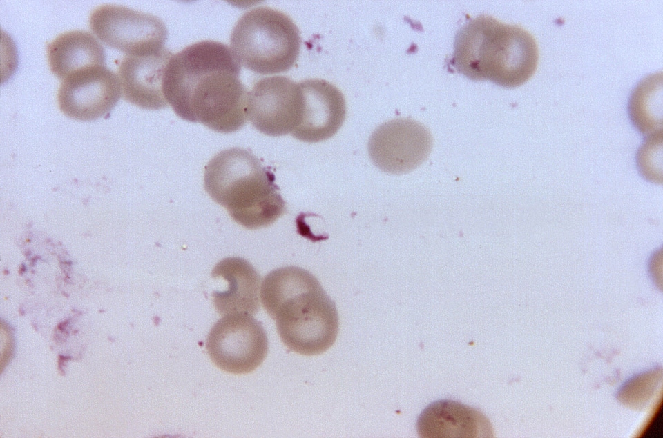 Gametocyte morphology photomicrograph photo
