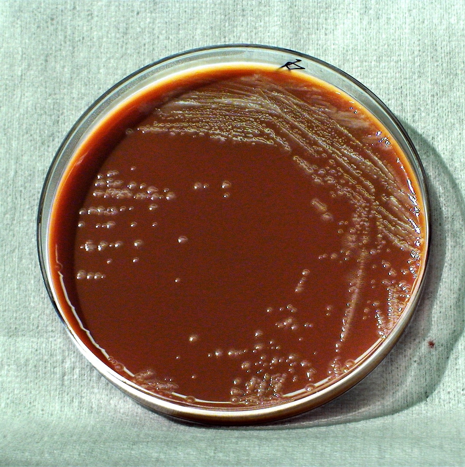Bacteria chocolate gram