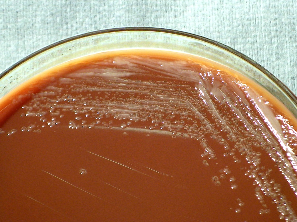 Bacteria colonial gram