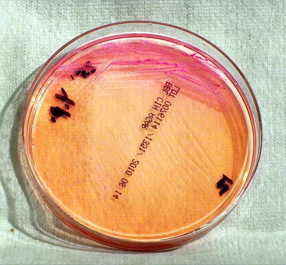 Bacteria gram negative