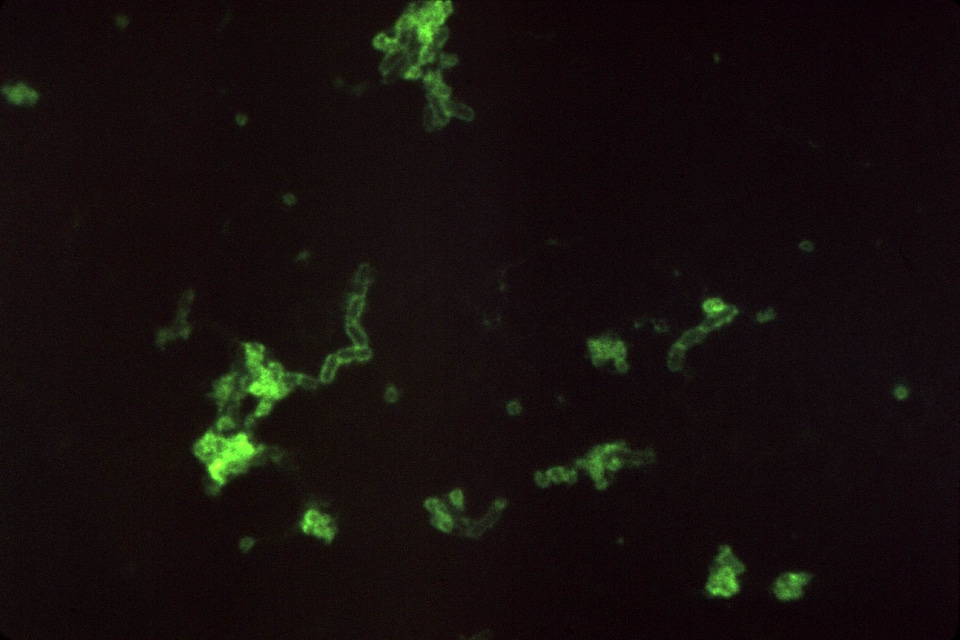 Antibody bacteria scrub