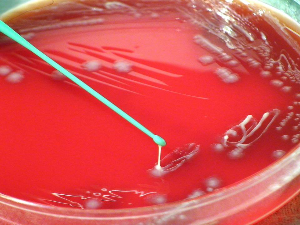 Bacteria blood hour