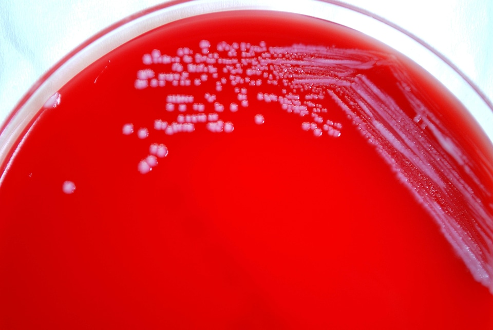 Bacteria blood blood agar