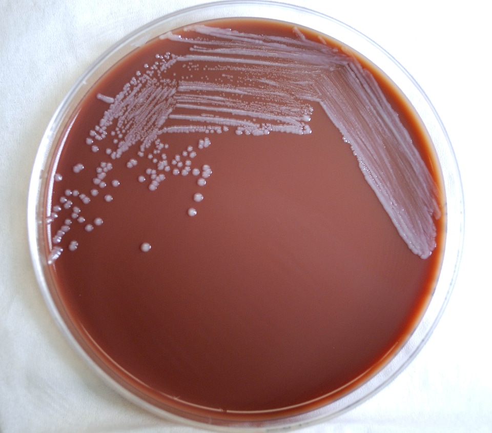 Bacteria blood agar colonial