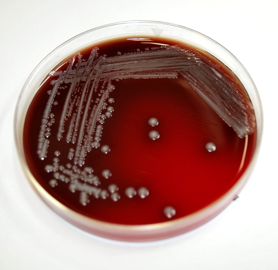Bacteria blood agar gram