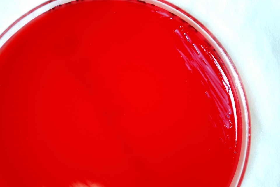 Bacteria blood agar celsius