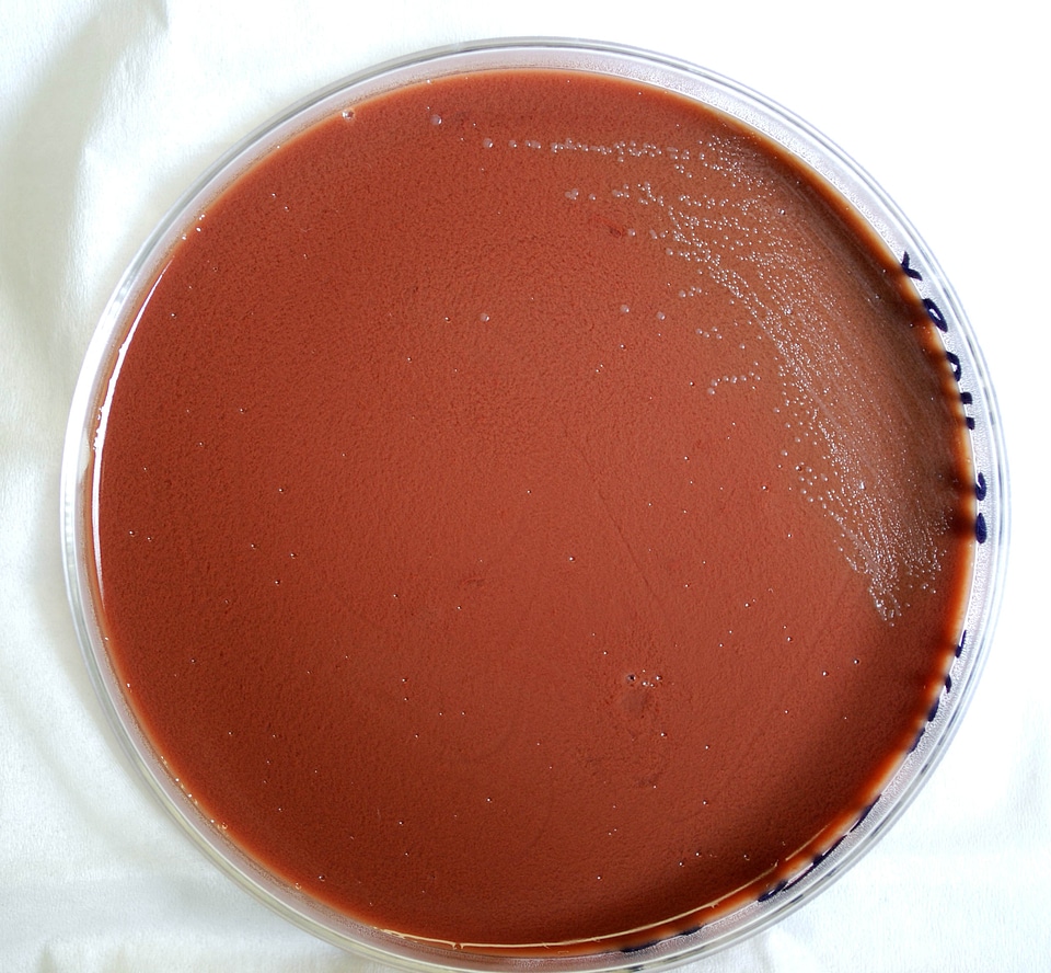 Blood Agar blood analysis disease