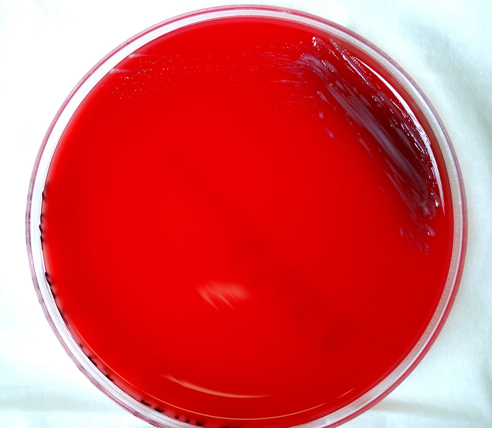 Bacteria blood agar celsius
