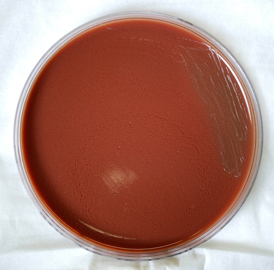 Blood Agar blood analysis labor