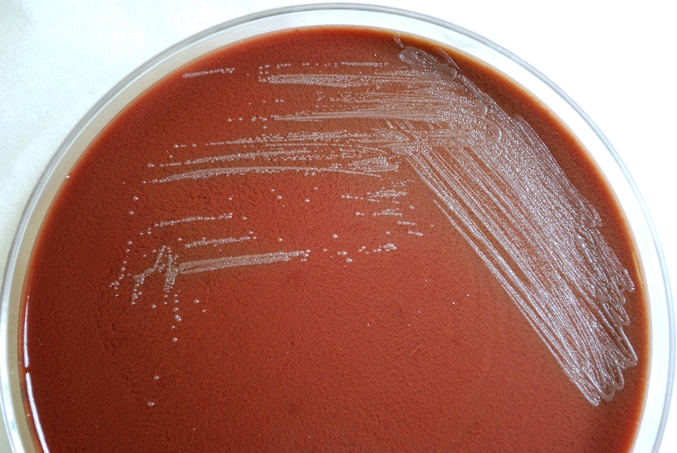 Bacteria blood blood agar