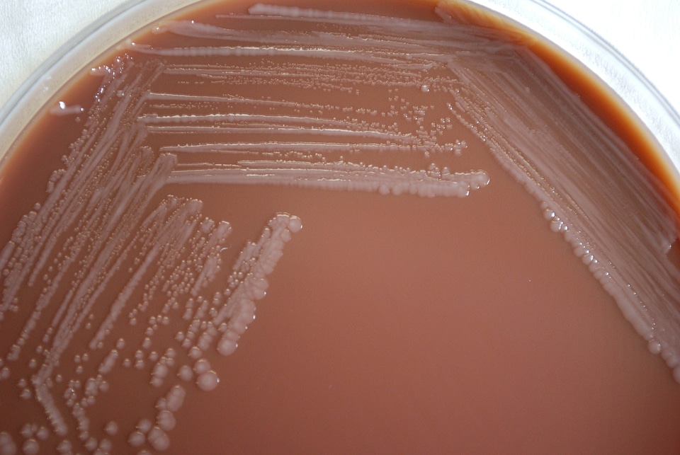 Bacteria blood agar chocolate