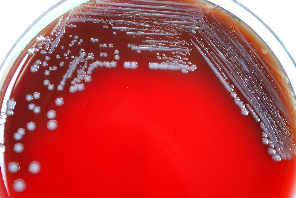 Bacteria blood blood agar