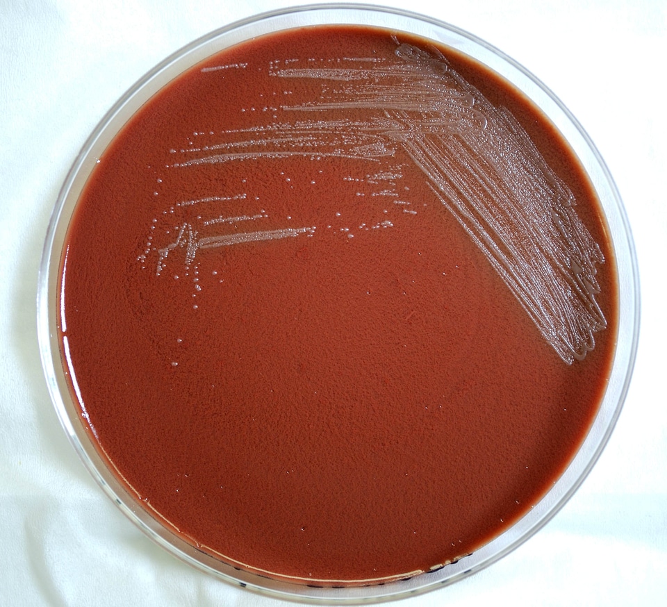 Bacteria petri dish plague photo