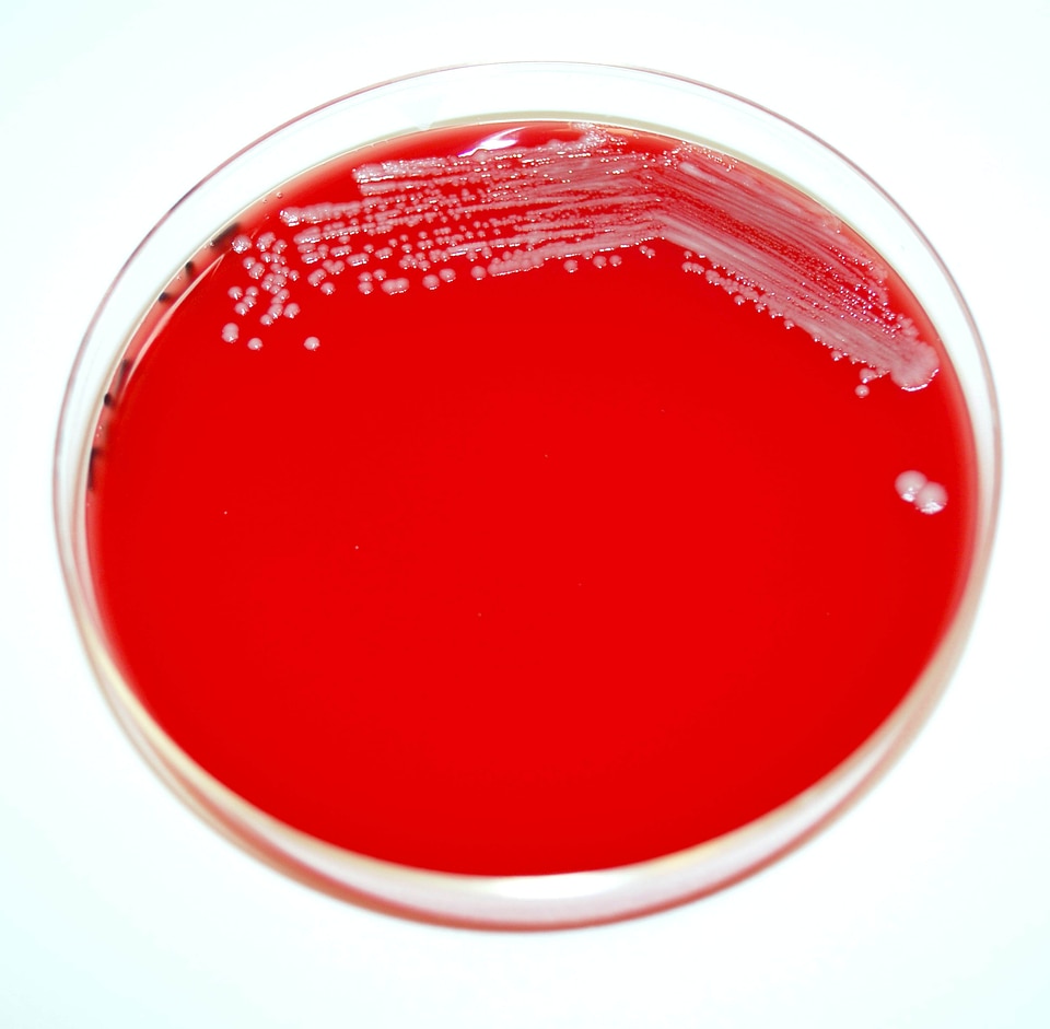 Bacteria gram negative
