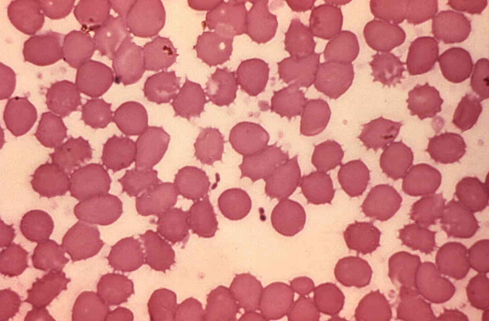 Bacteria blood cervical smear