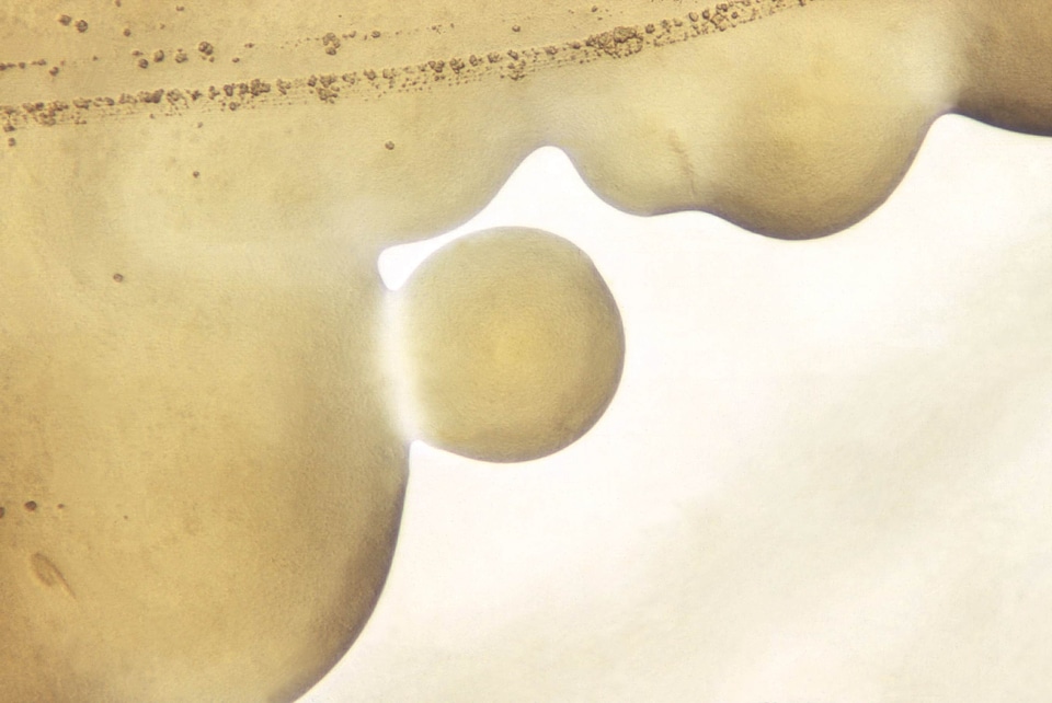 Appearance morphologic 