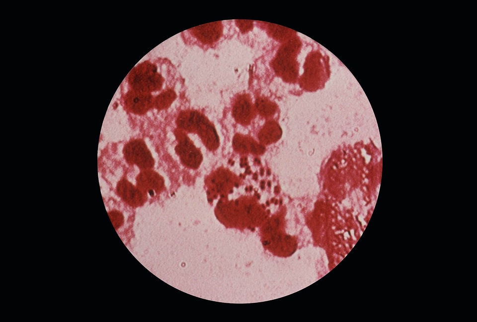 Discharge gram negative