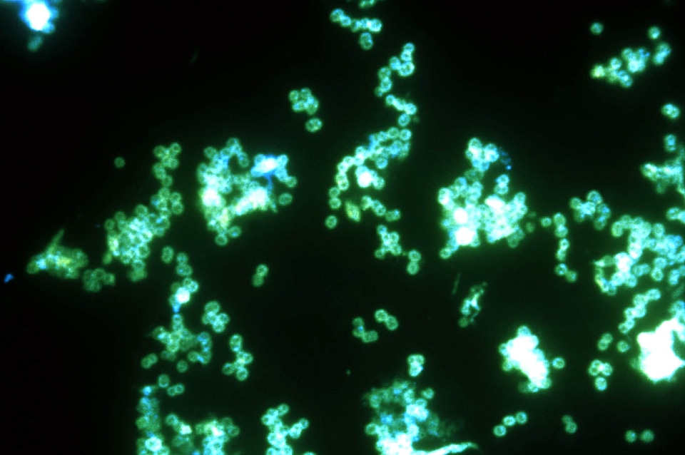Antibody gram negative