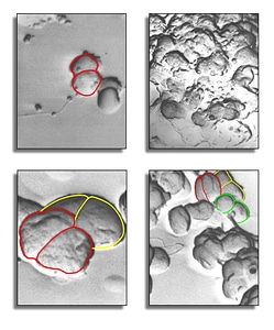 Bacteria gram negative photo