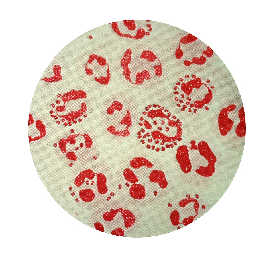 Gram photomicrograph scrub