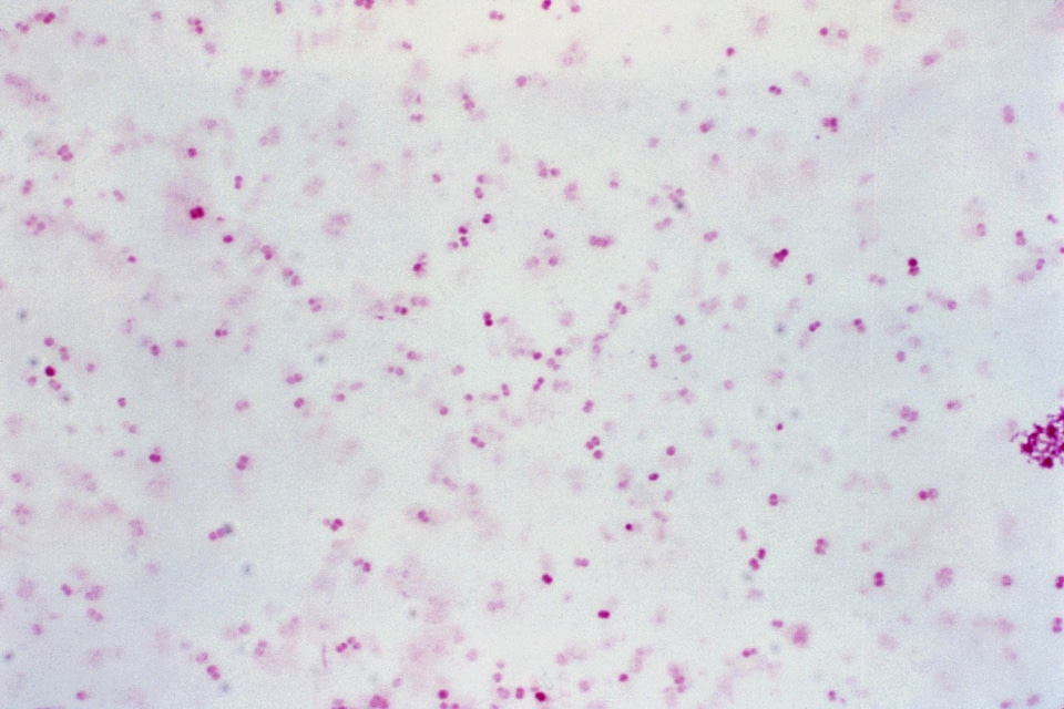 Gram negative presence