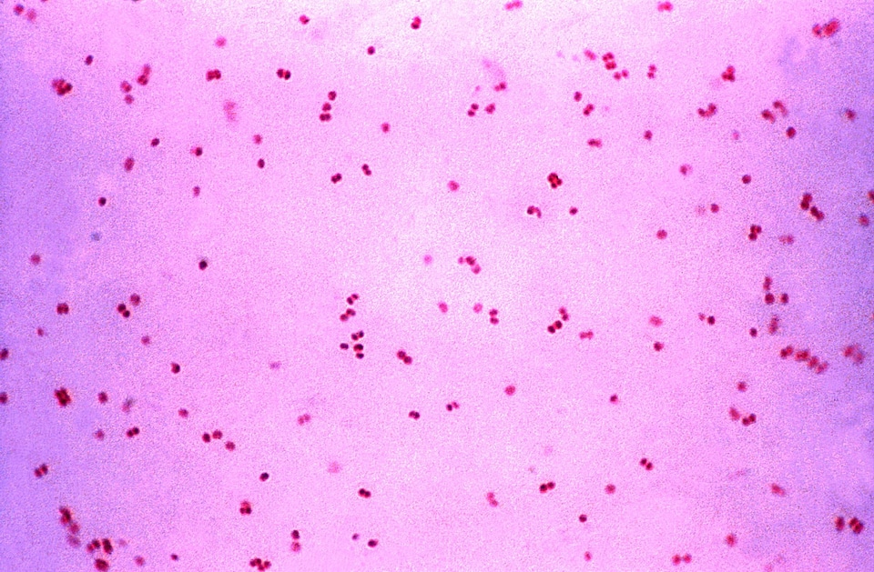 Bacteria gram negative photo