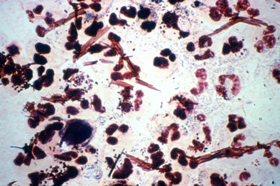 Bacteria discharge gram
