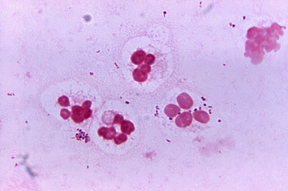 Bacteria flora presence