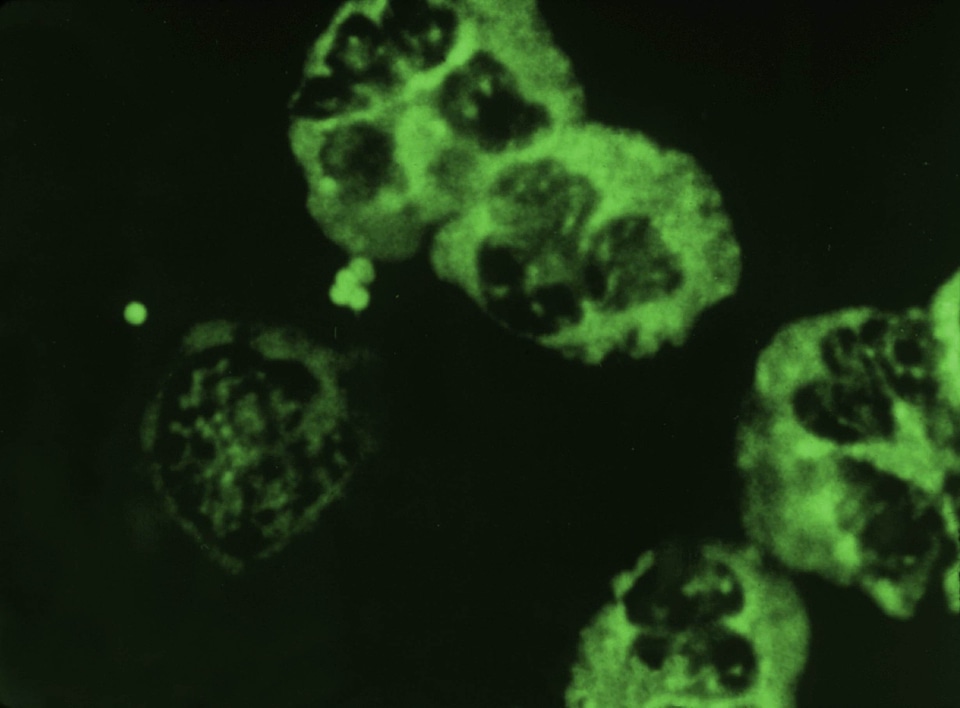 Bacteria gram negative