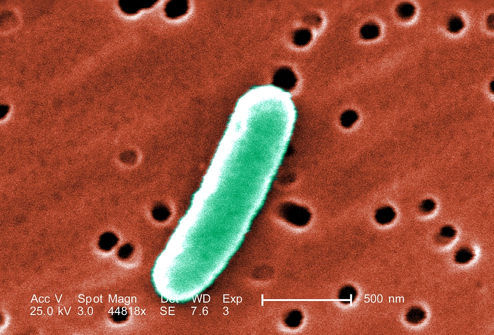 Details escherichia gram