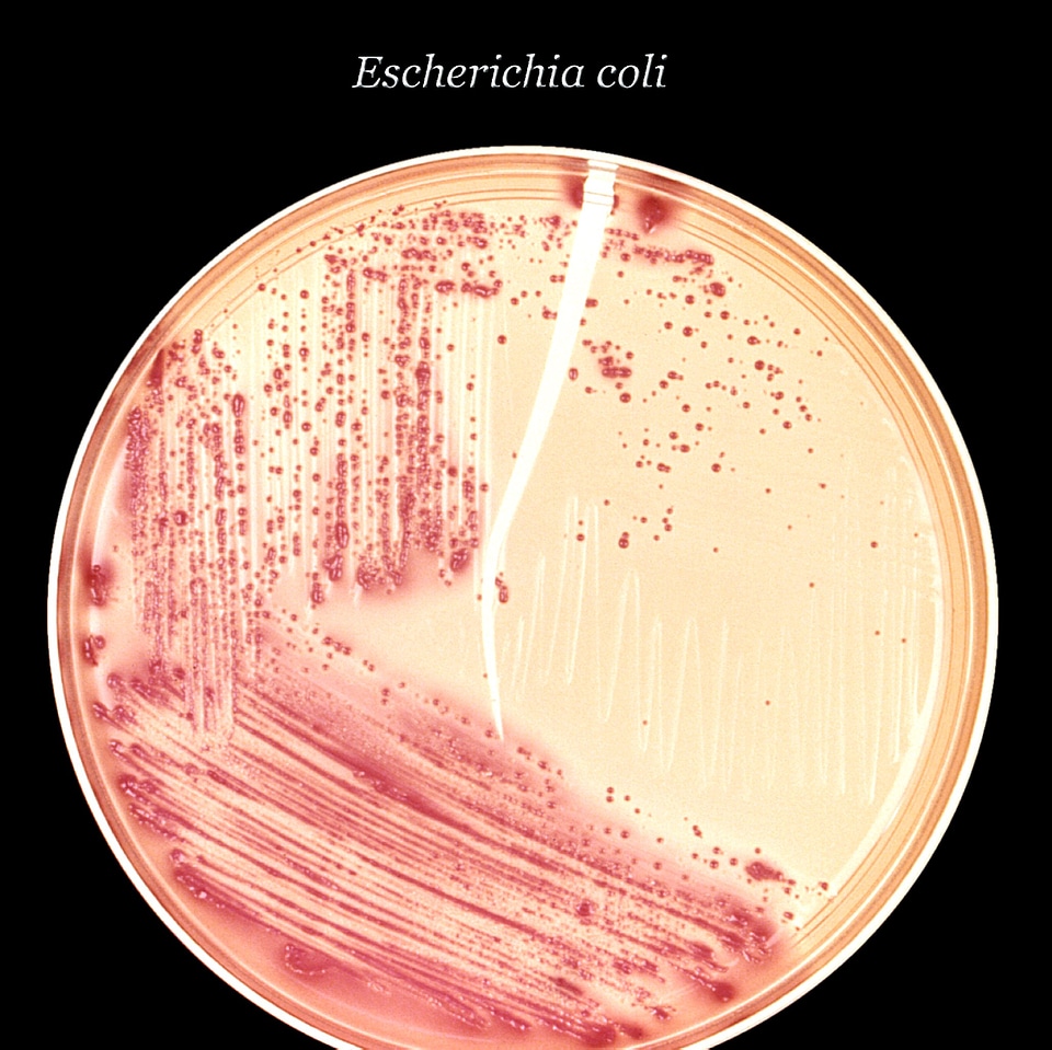 Bacteria colonial culture