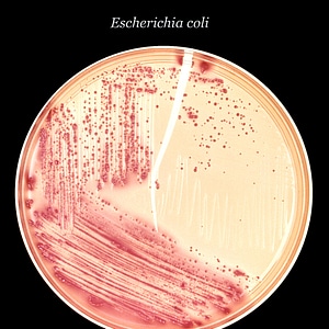 Bacteria colonial culture