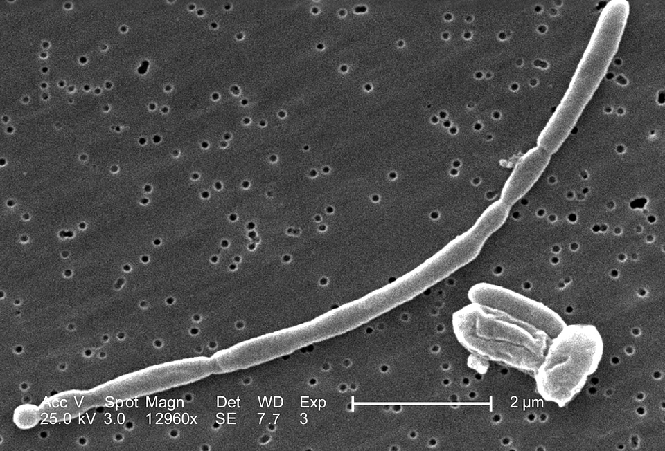 Bacteria details escherichia