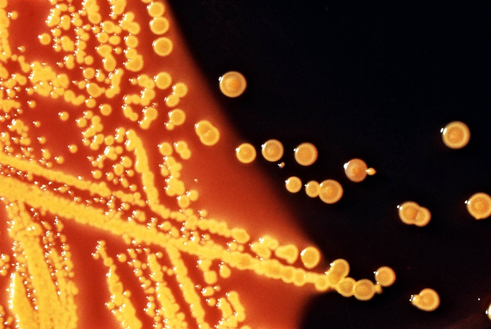 Bacteria escherichia means