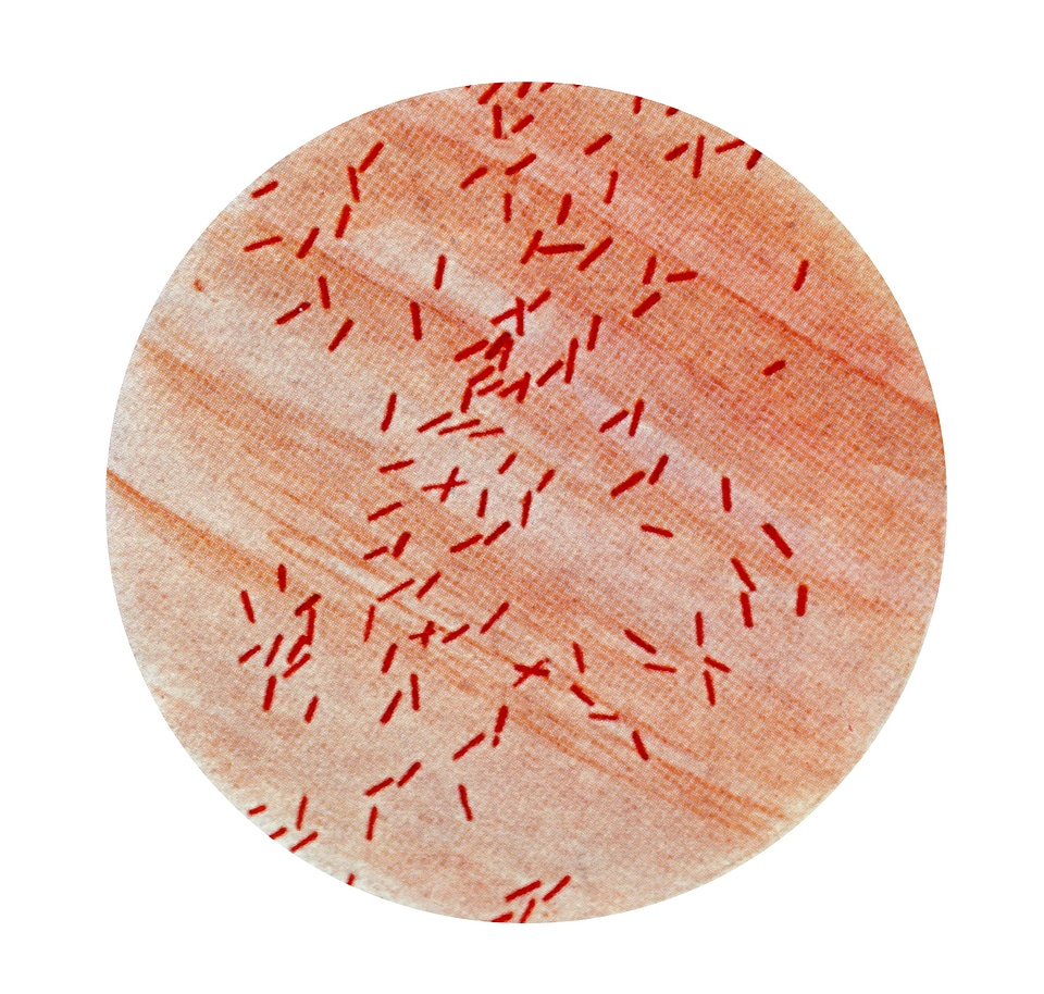 Bacillus bacteria escherichia