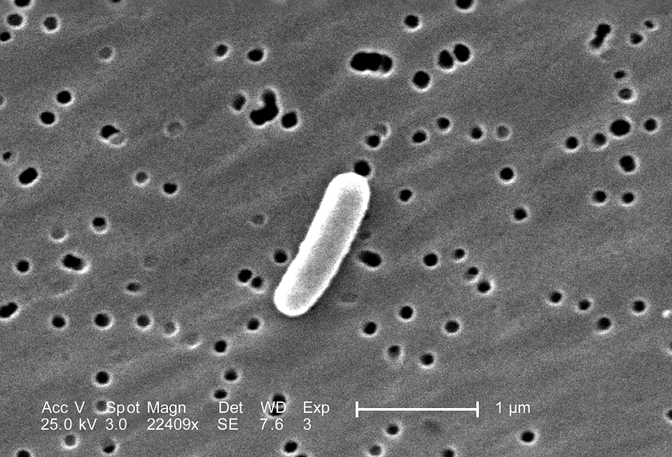 Escherichia gram negative