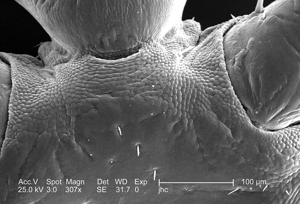 Female louse surface