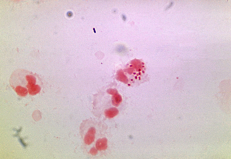 Flora neutrophil note