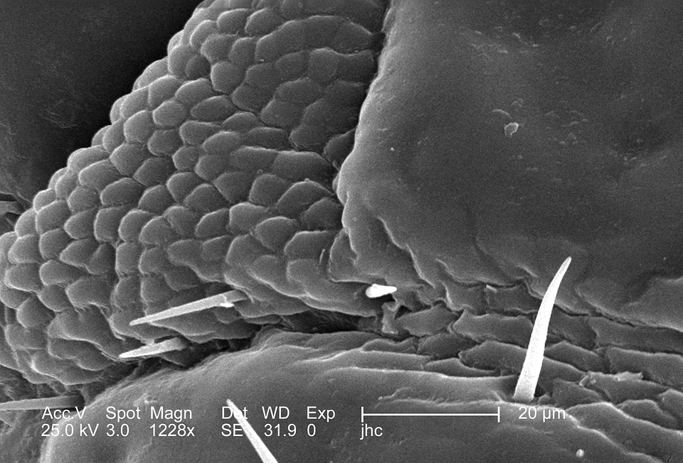 Female louse surface