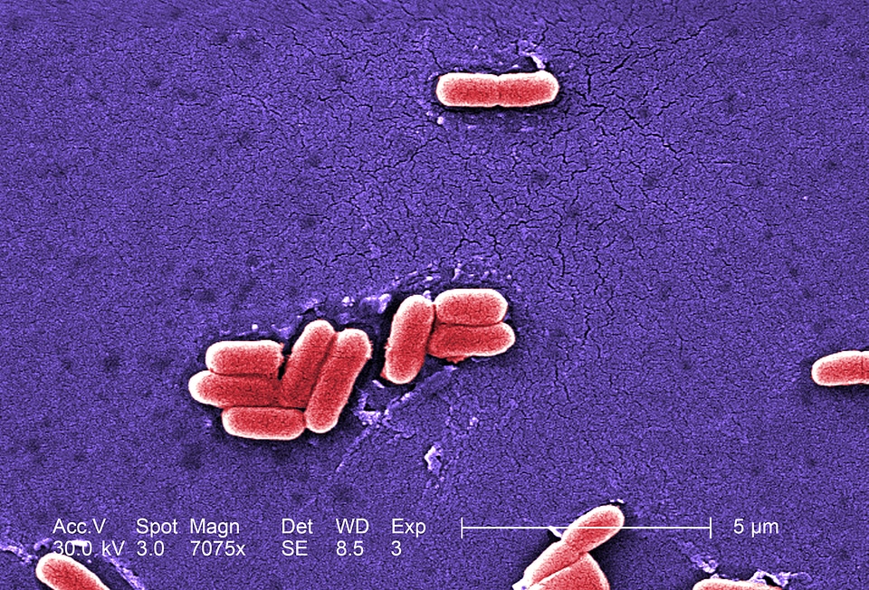 Abdominal diarrhea infection