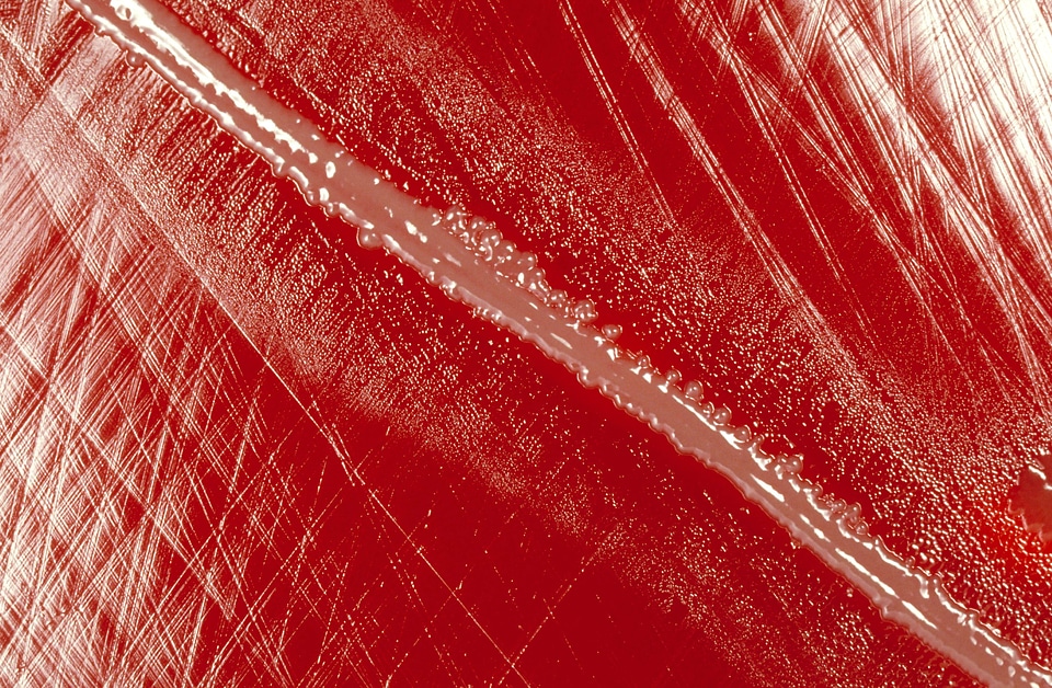 Around blood blood agar