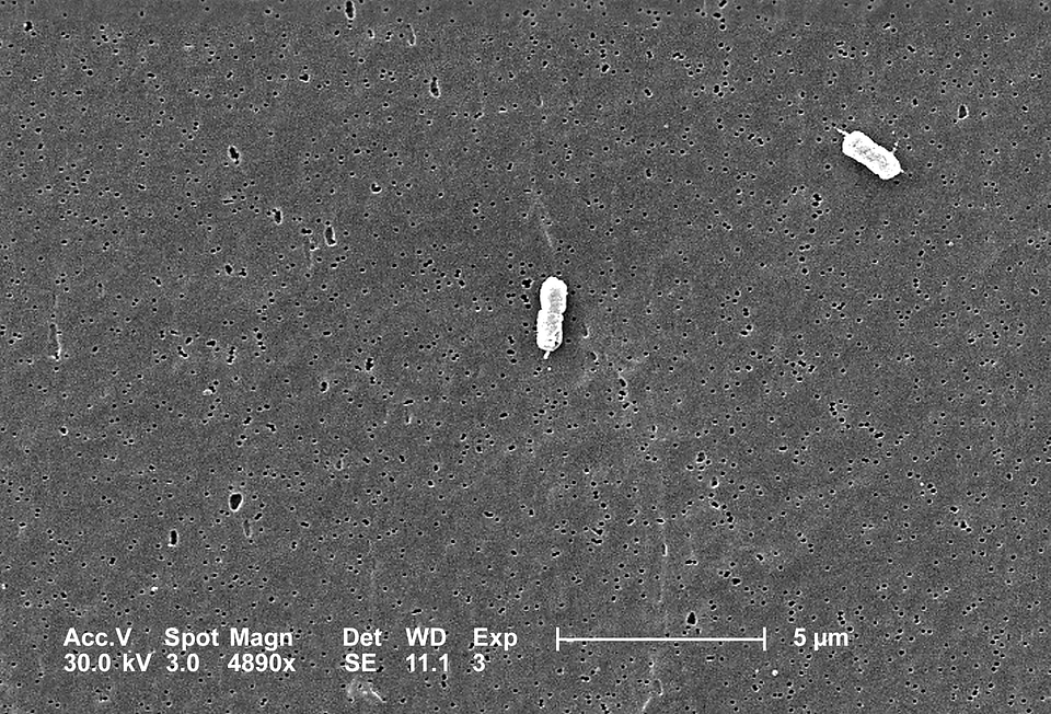 Bacteria escherichia 