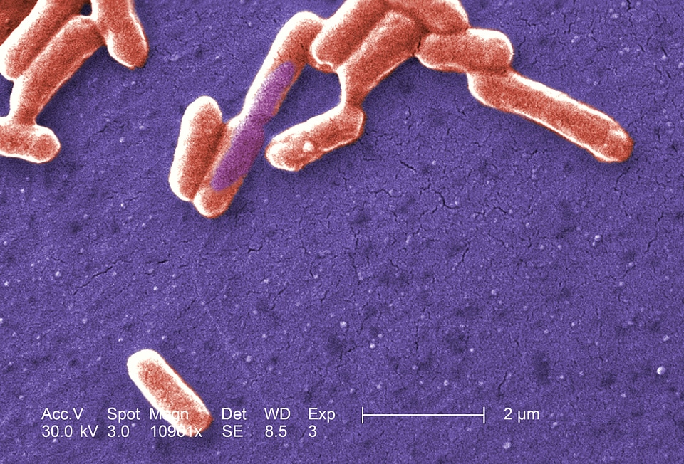Bacteria escherichia gram