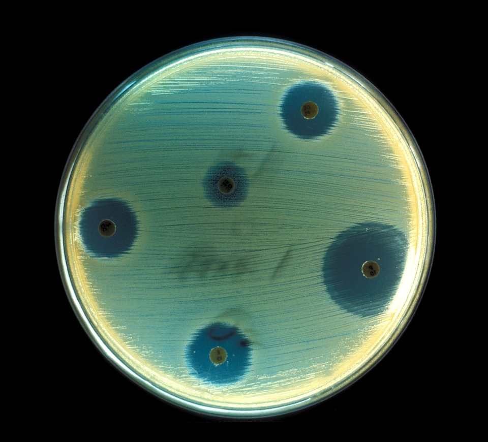 Disease intoxication toxin
